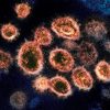 Image of SARS-CoV-2 (the virus causing the COVID-19 pandemic). Photo: NIH Image Gallery / NIAID-RML (Public domain). Elcano Blog
