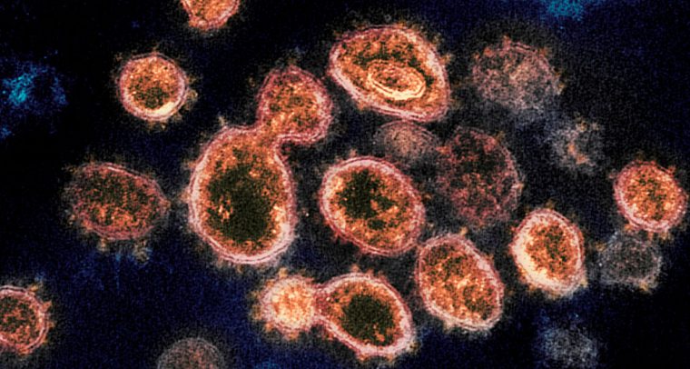 Imagen del SARS-CoV-2 (el virus causante de la pandemia del COVID-19). Foto: NIH Image Gallery / NIAID-RML (Dominio público). Blog Elcano