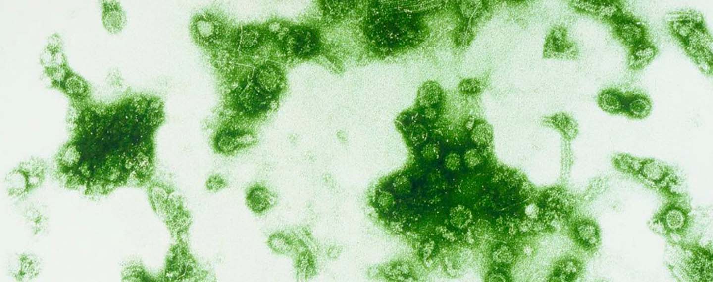 Virus del dengue visto al microscopio electrónico. Dengue en América Latina