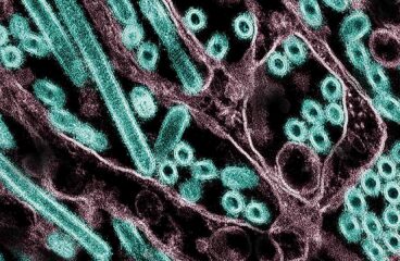 Micrografía electrónica de transmisión coloreada de partículas del virus H5N1 de la gripe aviar