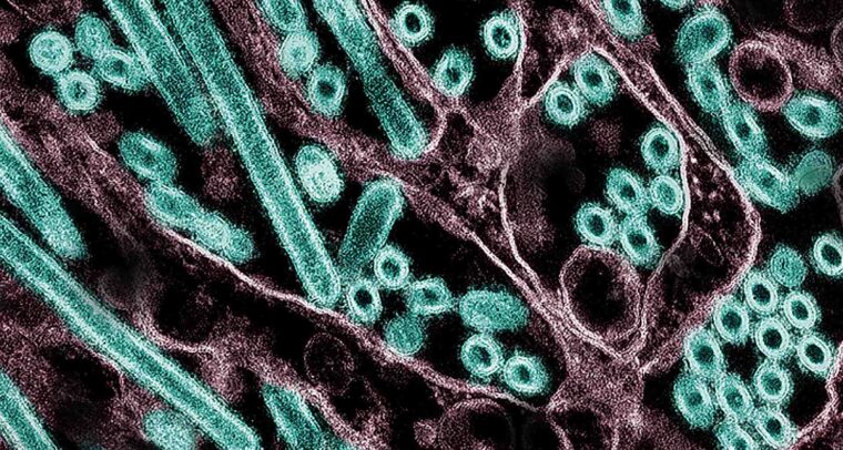 Micrografía electrónica de transmisión coloreada de partículas del virus H5N1 de la gripe aviar