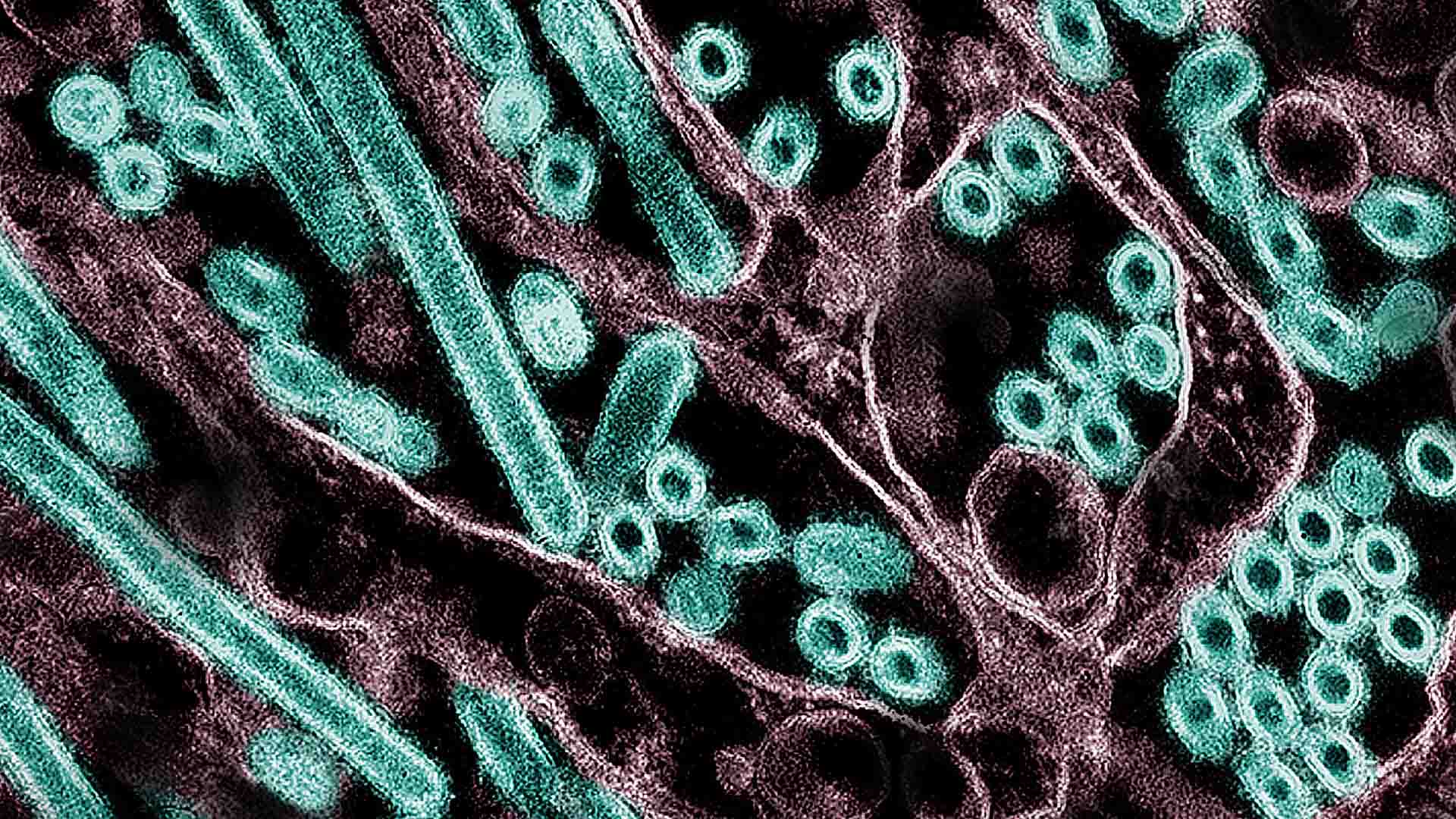 Micrografía electrónica de transmisión coloreada de partículas del virus H5N1 de la gripe aviar