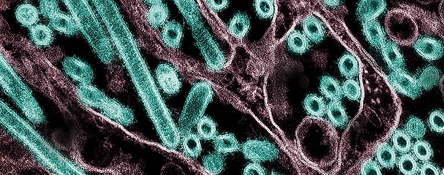 Micrografía electrónica de transmisión coloreada de partículas del virus H5N1 de la gripe aviar A. gripe aviar H5N1